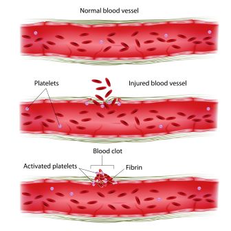 blood clotting process