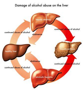 alcohol abuse on liver