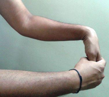 wrist extensor stretch