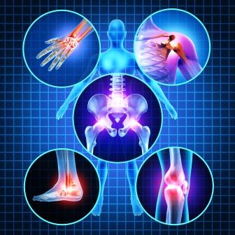 arthritis