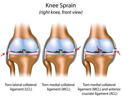 knee injury - ACL, MCL, LCL