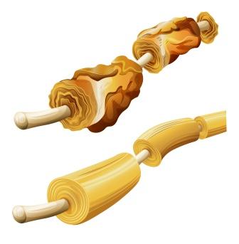 Myelin sheath damage