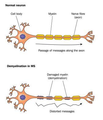 Myelin sheath