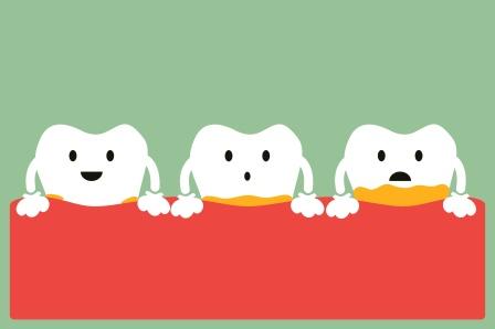 dental plaque and tartar development on teeth